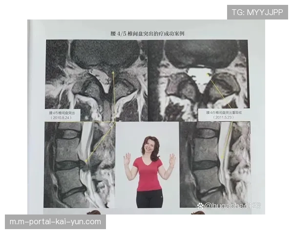 梁靖崑因腰腿旧伤连续退赛 医疗评估显示腰椎间盘突出达五毫米 梁靖崑因腰腿旧伤连续退赛 医疗评估显示腰椎间盘突出达五毫米